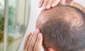 Best Hair Regrowth Oil For Baldness
